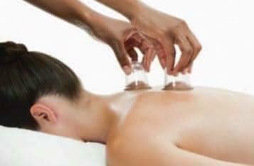 Does Cupping Work
